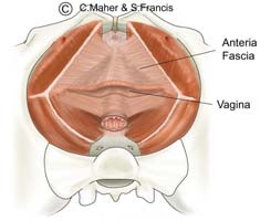 Diagram of a female pelvis indicating the anteria fascia and the vagina